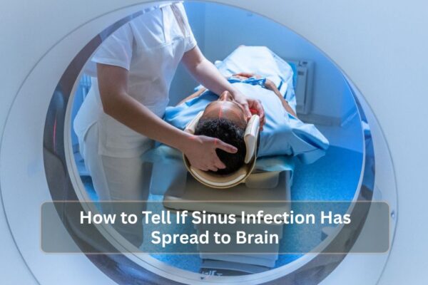 How to Tell If Sinus Infection Has Spread to Brain How to Tell If Sinus Infection Has Spread to Brain