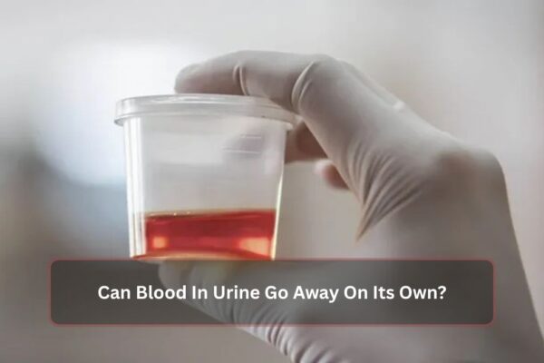 Can Blood In Urine Go Away On Its Own