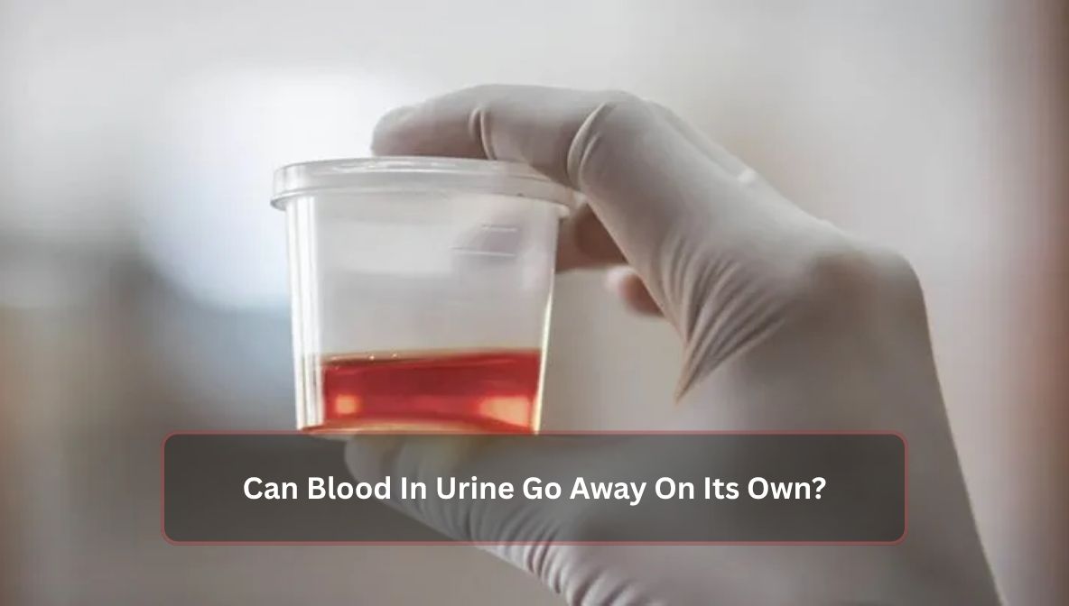 Can Blood In Urine Go Away On Its Own