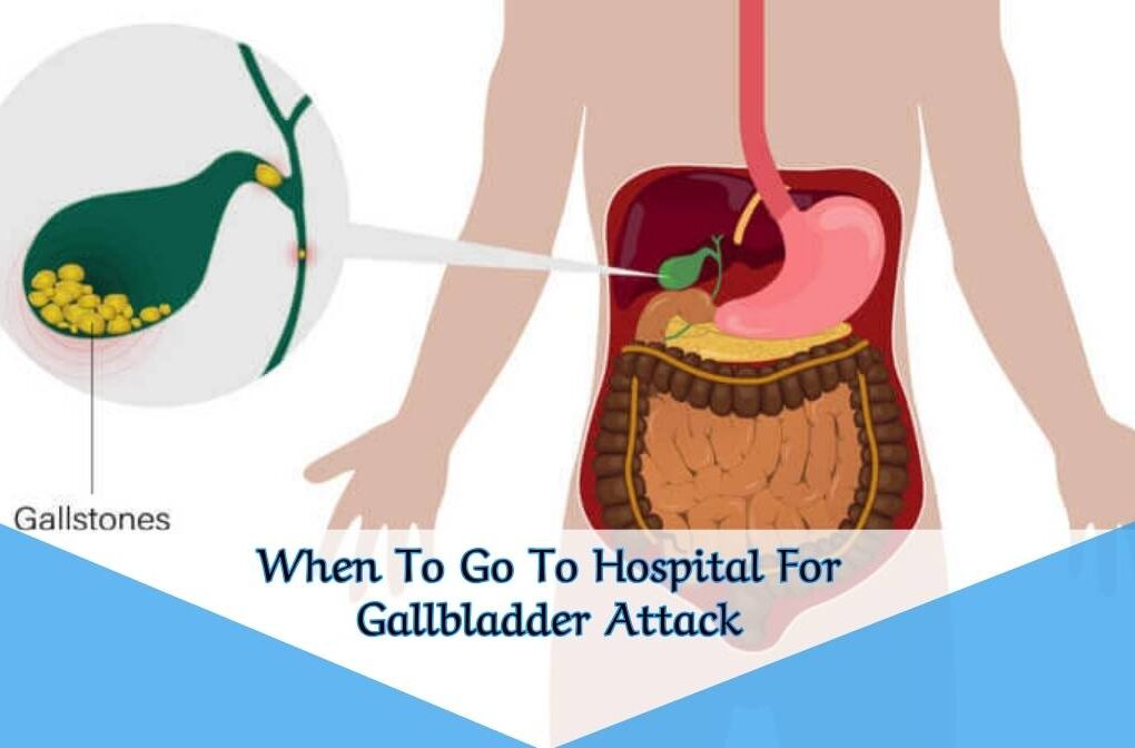 When To Go To Hospital For Gallbladder Attack