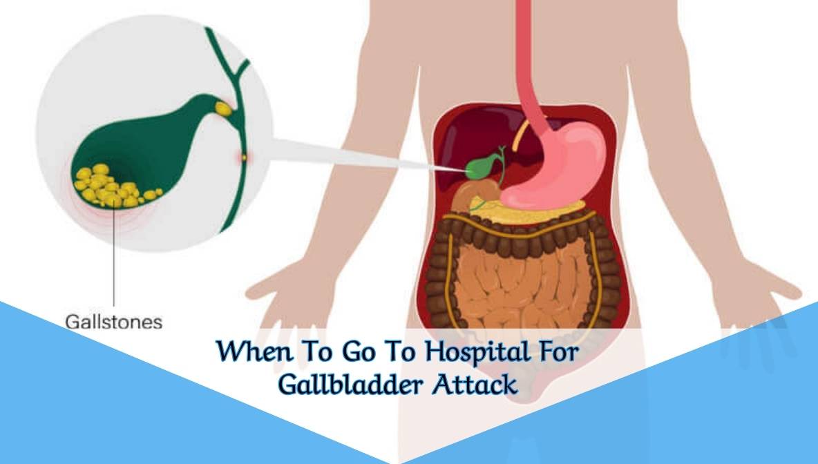 When To Go To Hospital For Gallbladder Attack